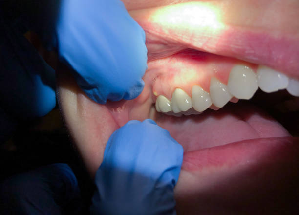 Best Urgent Dental Care  in Middletown, VA